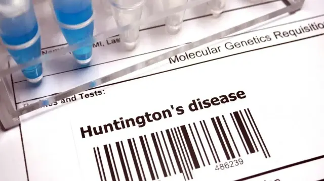 huntington hastaliginda tarihi gelisme yeni tedavi yuzde 75 yavaslatiyor v2n9ACJr