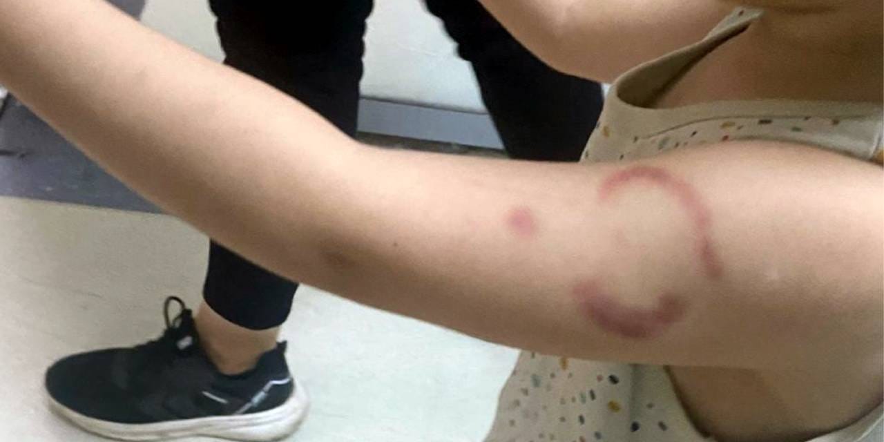 ogretmen 3 yasindaki ogrenciyi isirdi dMgKfkb9.jpg